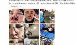 网友爆料被打脸视频大全,真相与反转的较量